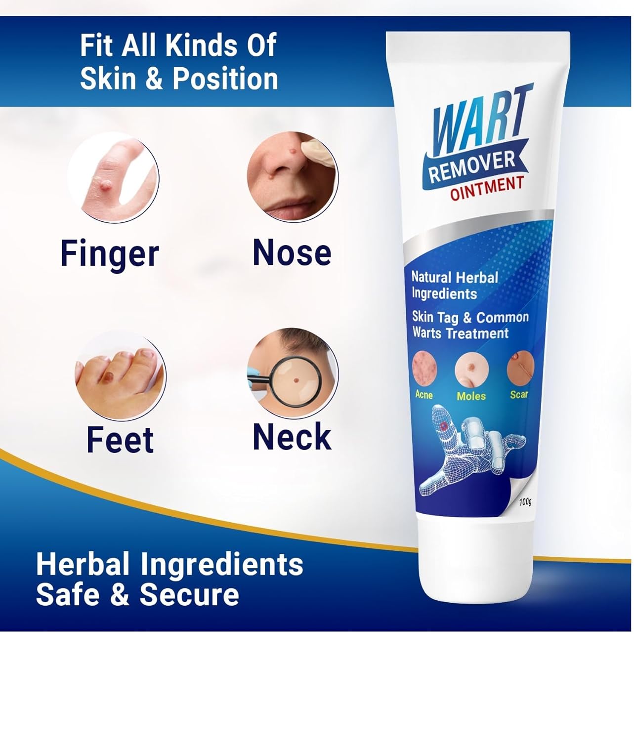 Medigo Wart remover ointment, Wart remover cream for Wart removal (100gm) | massa remover ointment for skin tag