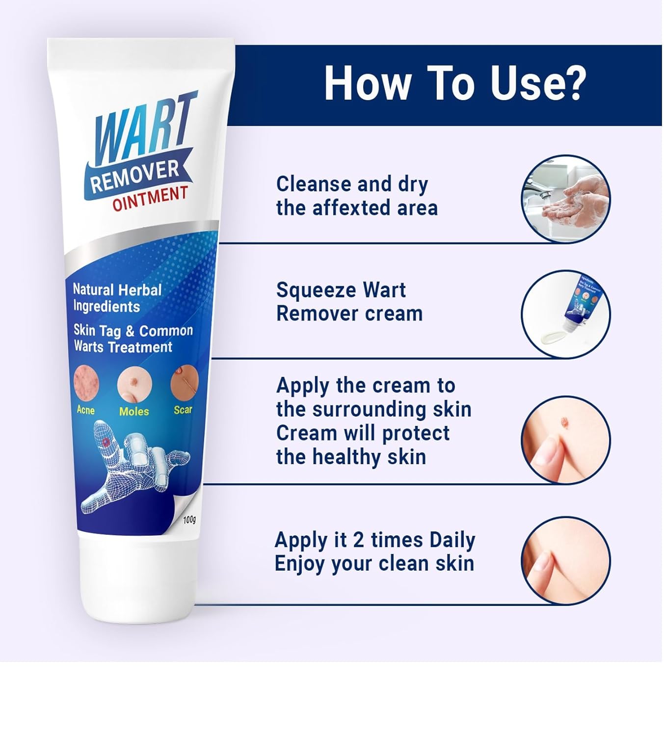 Medigo Wart remover ointment, Wart remover cream for Wart removal (100gm) | massa remover ointment for skin tag